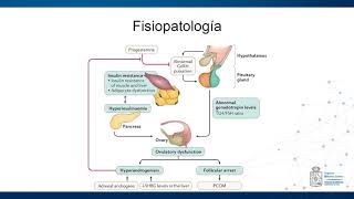 Fisiopatología Síndrome de Ovario Poliquístico [upl. by Lezlie]
