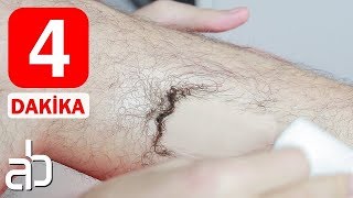 4 DAKİKADA Ağrısız KILLARINDAN KURTUL  │ Bakım ve Güzellik │ Aras Barlas [upl. by Ayotahs737]