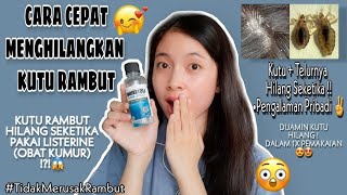 Cara Menghilangkan Kutu Rambut Cuma Pakai Obat Kumur  KUTU HILANG SEKETIKA  💕🥰  Dvna Natalia [upl. by Notsud]