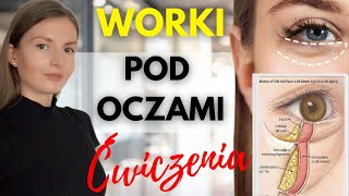 WORKI POD OCZAMI  jak zlikwidować [upl. by Acino]