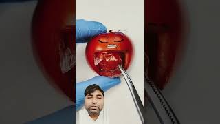 Food Surgery Apple banana tamato avacado gsviral funny comedy fun [upl. by Niarbo]