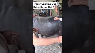 Trocar Cannula  Bloat  अफरा या पेट फूलने पर ट्रॉकर कैन्नुला कैसे डालें [upl. by Hgielsa]