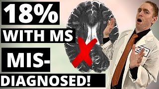 18 with Multiple Sclerosis are Misdiagnosed Data from UCLA and Cedar Sinai [upl. by Akinam190]