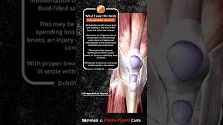 Infrapatellar bursitis  Dr Notley Chiropractor and Athletic Therapist in Winnipeg [upl. by Cut]