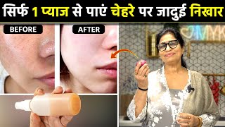 सिर्फ 7 दिन चेहरे पर लगाएं कितने भी मुश्किल झाइयां Melasma कालेधब्बे 100 गायब  DIY Face Serum [upl. by Carmelina281]