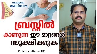 ബ്രസ്റ്റിൽ കാണുന്ന ഈ മാറ്റങ്ങൾ സൂക്ഷിക്കുക  Fibroadenoma  Dr Noorudheen NK [upl. by Ellirpa]