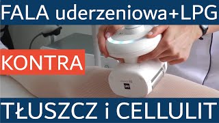 Endermologie LPG Alliance i fala uderzeniowa STORZ  w walce z tkanką tłuszczową i cellulitem [upl. by Weiser]