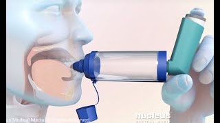 How to Use a Metered Dose Inhaler with a Spacer [upl. by Atirhs19]