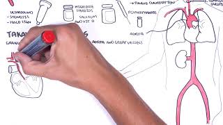 Giant cell Arteritis and Takayasu arteritis Large Vessel Vasculitis  signs pathophysiology [upl. by Box]