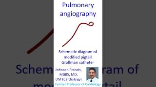 Pulmonary angiography [upl. by Eeralav]