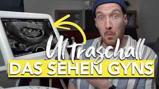 Was ist das Ultraschall in der Schwangerschaft enträtselt I vom Embryo bis zum Baby [upl. by Niuqram613]