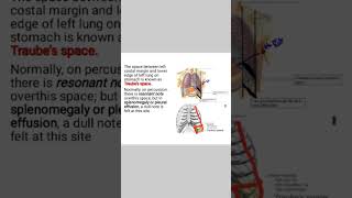 TRABUES SPACE anatomy SURGERYmedicine Livealife55 [upl. by Fayre]