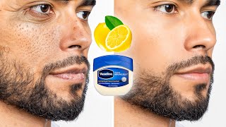 How To Fix Your Skin Problems For Men Over 30 [upl. by Atalanti]