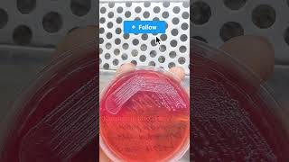 klebsiella in MacConkey Agar। microscope microbiology bacteria youbtube science [upl. by Arriaes194]