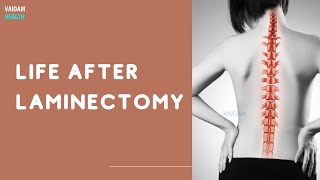 Life After Laminectomy [upl. by Hanshaw]