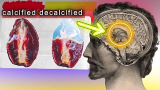 The Secret To Decalcifying The Pineal Gland  HOW TO [upl. by Aed700]