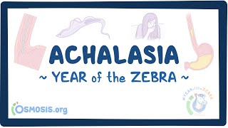 Achalasia Year of the Zebra [upl. by Hackathorn]