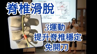 脊椎滑脫，3運動提升脊椎穩定，免開刀【琵塔琪 物理治療師】教學直播 [upl. by Gracye80]