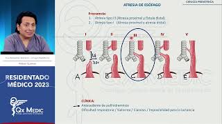 Cirugía pediátrica  1 Atresia de esófago [upl. by Trilbi]