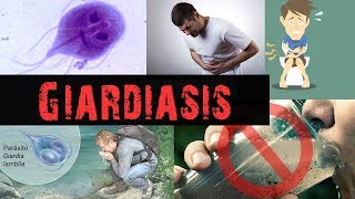 What is Giardiasis   Giardia lamblia Infections [upl. by Ancelin]