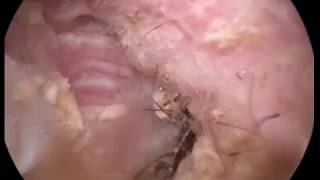 Ear wax cleaning in dog Otoscopy wwwendovetcom [upl. by Aicirtac729]