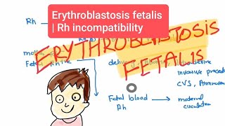 Erythroblastosis fetalis haematology 27 First Aid USMLE Step 1 in UrduHindi [upl. by Tavey]