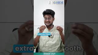 Dry Socket Dilemma  SRM Kattankulathur Dental College amp Hospital  SRMIST [upl. by Nytnerb]