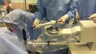 ELMED USA RobofleX Avicenna Robotic Flexible Ureteroscopy [upl. by Girardi]