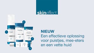 NIEUW De effectieve oplossing voor puistjes meeeters en vette huid  Skineffect onzuivere huid [upl. by Atteirneh]