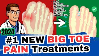 1 Big Toe Joint Pain Cure Arthritis Sesamoiditis Turf Toe Gout [upl. by Featherstone]