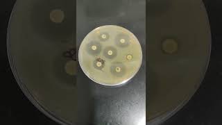 Antibiotic Susceptibility test [upl. by Currier]