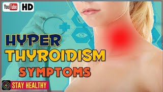 8 Hyperthyroidism Signs and Symptoms [upl. by Lundberg]