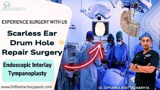 Endoscopic Ear Drum hole repair surgery Tympanoplasty  Experience Surgery with Dr Bhattacharyya [upl. by Rachaba6]