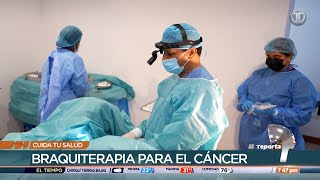 Cuida tu Salud Braquiterapia contra el cáncer [upl. by Vivie]