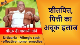 Allergic RashUrticaria  Effective Home Remedies  शीतपित्त पित्ती का अचूक इलाज [upl. by Doria994]