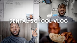 Dental School Vlog Preparing My Boards Study Schedule Fixed amp Removable Prosthodontics Are Back [upl. by Hsina]