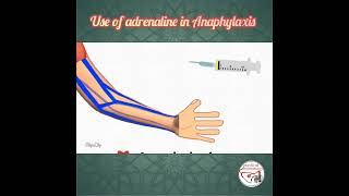 💉 HOW TO USE ADRENALINE EPINEPHRINE IN ANAPHYLAXIS  pediatrics medicine epinephrine [upl. by Naamann951]