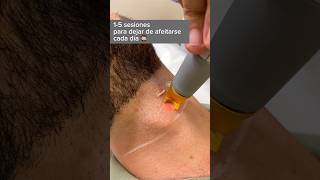 Cómo obtener una piel suave en el cuello con depilación depilación del cuello [upl. by Norehs669]