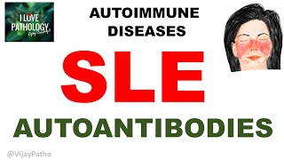 Autoimmune diseases Part 3 Systemic Lupus Erythematosus Autoantibodies [upl. by Haleak]