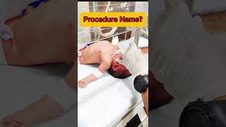 Procedure Name Human trachea ytshorts medical youtubeshorts nursing intubation hospital [upl. by Komara]