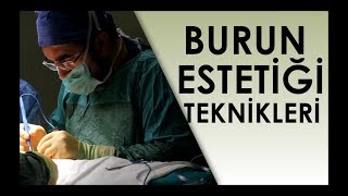 Burun Ameliyatı Teknikleri  Op Dr Ali Mezdeği [upl. by Akamahs80]