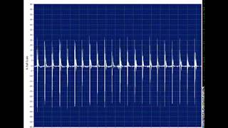 Transformer with loose winding Time Series view [upl. by Giliana]