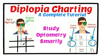 Diplopia Charting  A Complete Tutorial [upl. by Nitnert608]