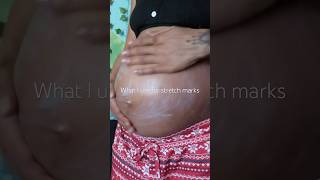 Best Stretch Mark Cream postpartum bellycare pregnantbelly pregnancymusthaves [upl. by Adniral]