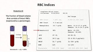 How to Interpret RBC Indices eg hemoglobin vs hematocrit MCV RDW [upl. by Ytirehc295]