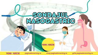 Sondajul nasogastric Tehnica AMG [upl. by Henn]