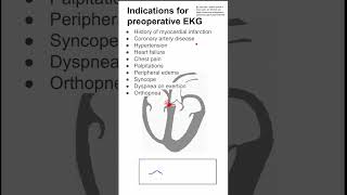 Indications for preoperative EKG [upl. by Ylliw]