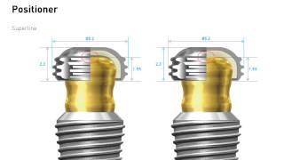 2D Manual Overdenture System [upl. by Harod]