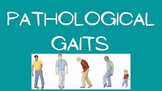 PATHOLOGICAL  ABNORMAL GAITS PART1 PRACTICAL DEMONSTRATION IN URDU  HINDI [upl. by Yanal]