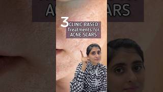 How to get rid of Acne Scars  Acne Scars Treatment  Acne Scars shorts [upl. by Shig]